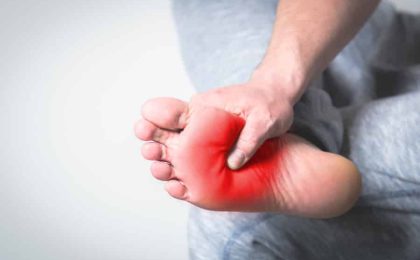 fascitis plantar