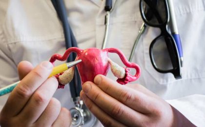 Endometriosis, una condición ginecológica que afecta a muchas mujeres