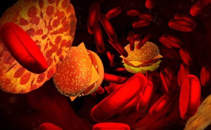 sobre el riesgo de demencia