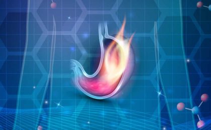 controlar el reflujo ácido