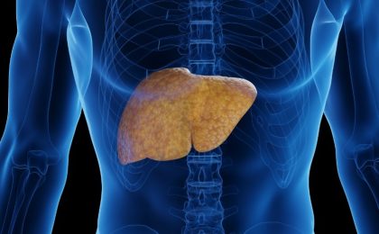 prevencion higado graso