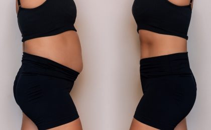 El tratamiento de la obesidad con moléculas señalizadoras